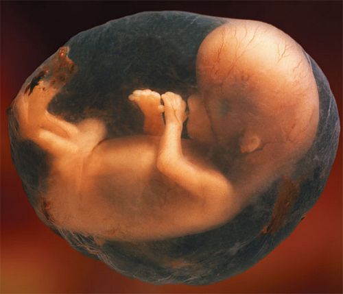 human fetus